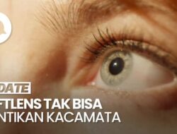 Dokter Spesialis Mata Sebut Softlens Tidak Bisa Gantikan Fungsi Kacamata