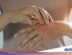 Sering Gatal dan Merasa Lemas, Pertanda Imun Tubuh Bermasalah Dok?