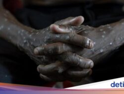 Wabah Mpox di Afrika Makin Ngeri, Ada 2 Ribu Kasus dalam Sepekan-Picu Korban Jiwa