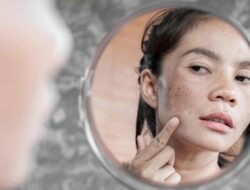 Kulit Susah Banget Glowing? Bisa jadi Skin Barrier Rusak, Ini Saran Dokter