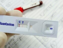 Ada 8 Kasus di RI, Apakah Virus Hanta Bisa Menular Antar-Manusia?