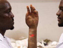 Keren, Lengan Bionik dari Nigeria Seperti Kulit Manusia