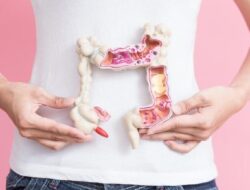Dokter Beberkan 5 Gejala Kanker Usus Besar pada Anak Muda yang Sering Diabaikan