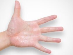 7 Trik Ampuh Atasi Tangan Panas karena Cabai