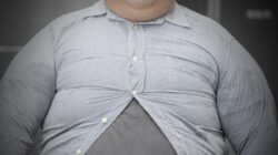 Kisah Pria 190 Kg Alami Gagal Ginjal Akibat Pola Makan Buruk