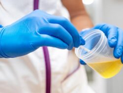 Dokter Wanti-wanti Urine Terlalu Jernih Tak Setiap Waktu Sehat, Kemungkinan Tanda Gangguan Ginjal