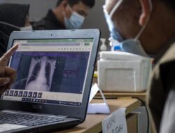 Skrining TB dan Cek Kesehatan Gratis Digelar bagi Warga Kawasan Karst